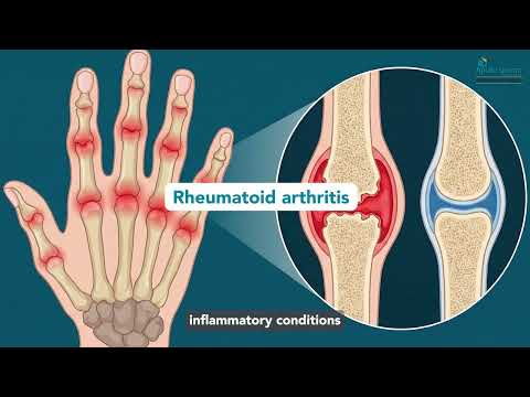 CV Junction - Dr. Mohit Muttha