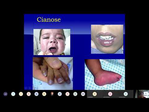 Semiologia do Aparelho Cardiovascular