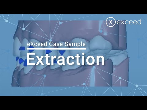 Extraction