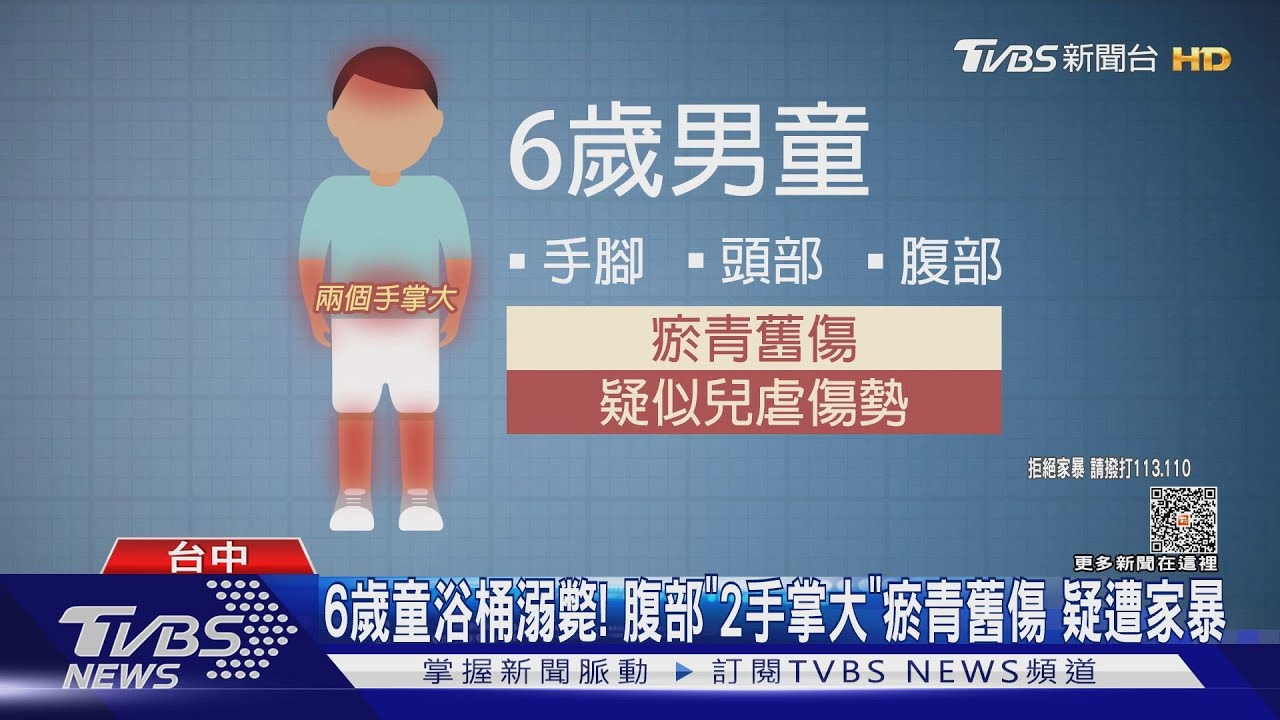 6歲童浴桶溺斃! 腹部「2手掌大」瘀青舊傷疑遭家暴