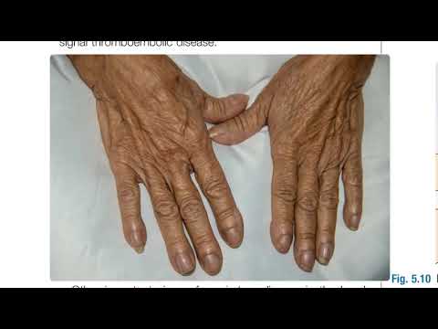 Macleod's Respiratory Examination: A Deep Dive