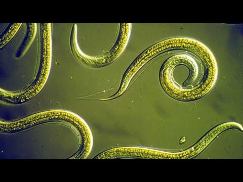 Phylum Nematoda Part 1: Introduction to the Roundworms