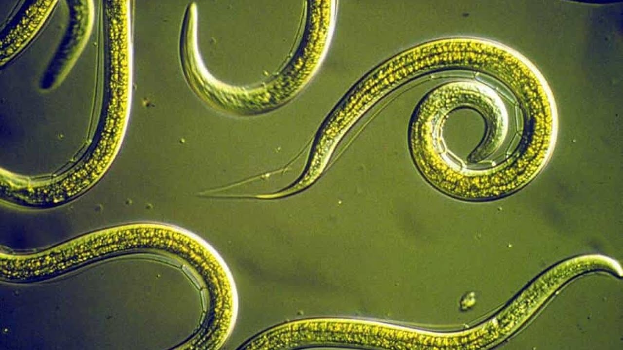 Phylum Nematoda Part 1: Introduction to the Roundworms