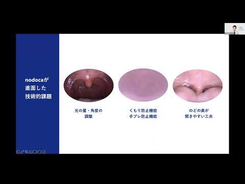 感染症判定AI咽頭カメラ