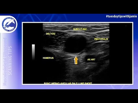 6-step protocol for imaging palpable lumps in the extremities