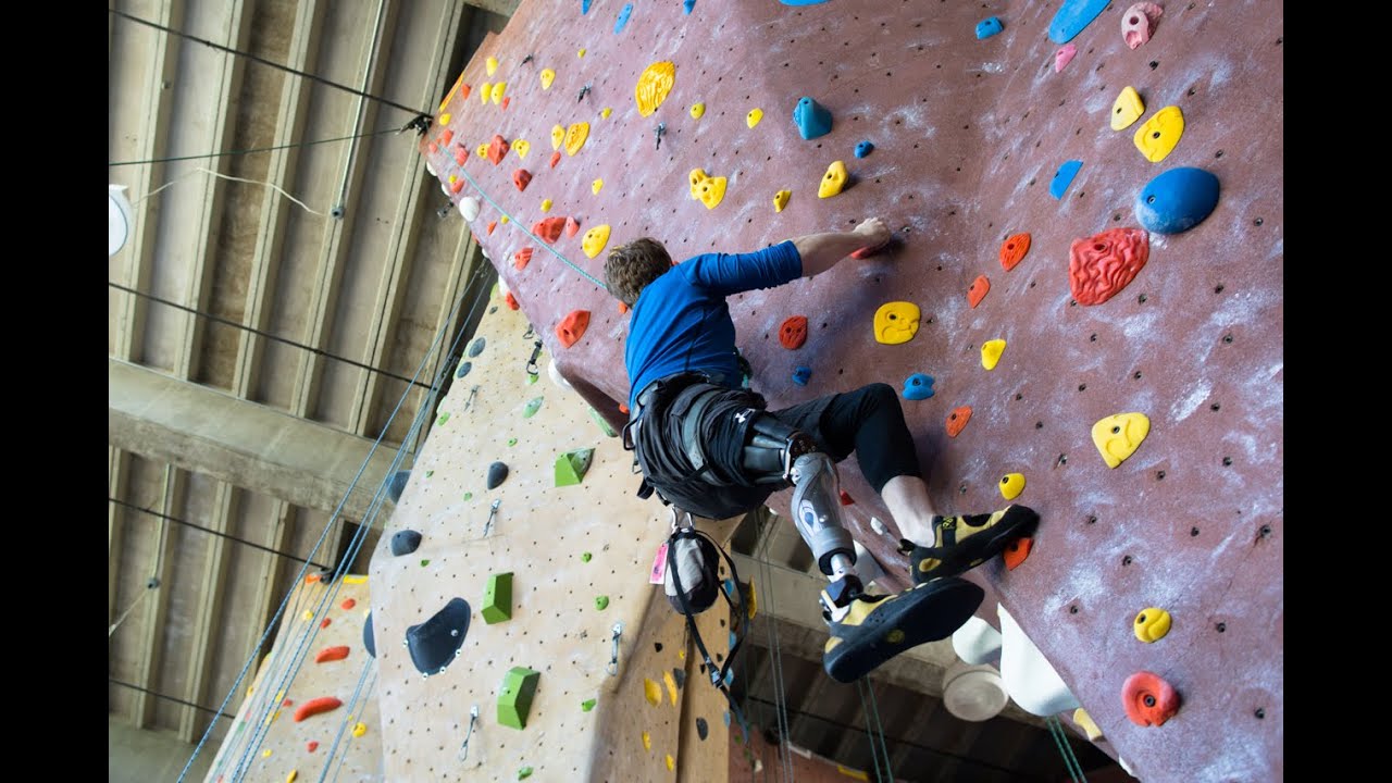 Prosthetic sockets go high-tech