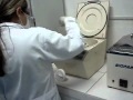 TECNICA URINA URINALISE Wmv YouTube