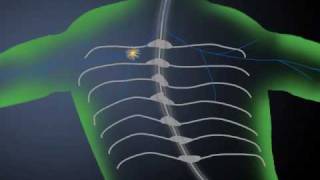 ACUPUNTURA NEUROFUNCIONAL