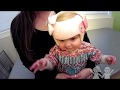 Cranial Remolding Helmet: Proper Fit and Care Video