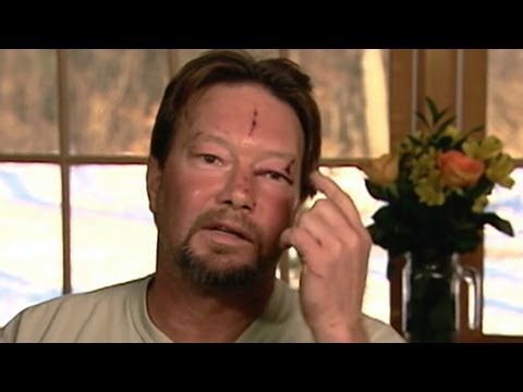 Bobcat Attacks Massachusetts Man in Garage