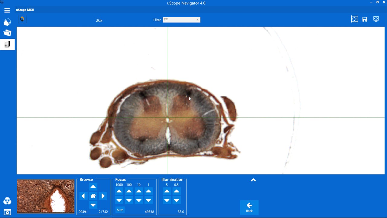 Browsing a Slide with the uScope Digital Microscope (video ...