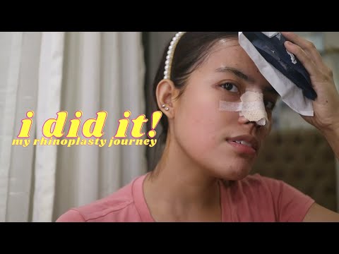 MY RHINOPLASTY JOURNEY (SURGERY DAY) PART 1 by CHASE