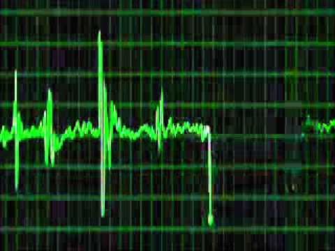 INSOMNIA - Killer Sound B