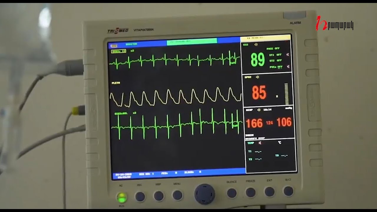 Արսեն Թորոսյանը վրեժ է լուծում ԵՊԲՀ-ից, պետպատվեր չի իջեցնելու