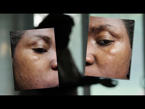 Witness21 Editor  2021 08 23