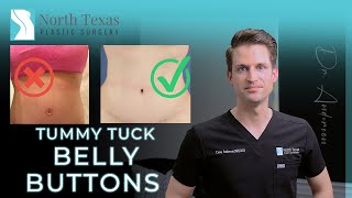 Belly Buttons | The Most Important Part of a Tummy Tuck