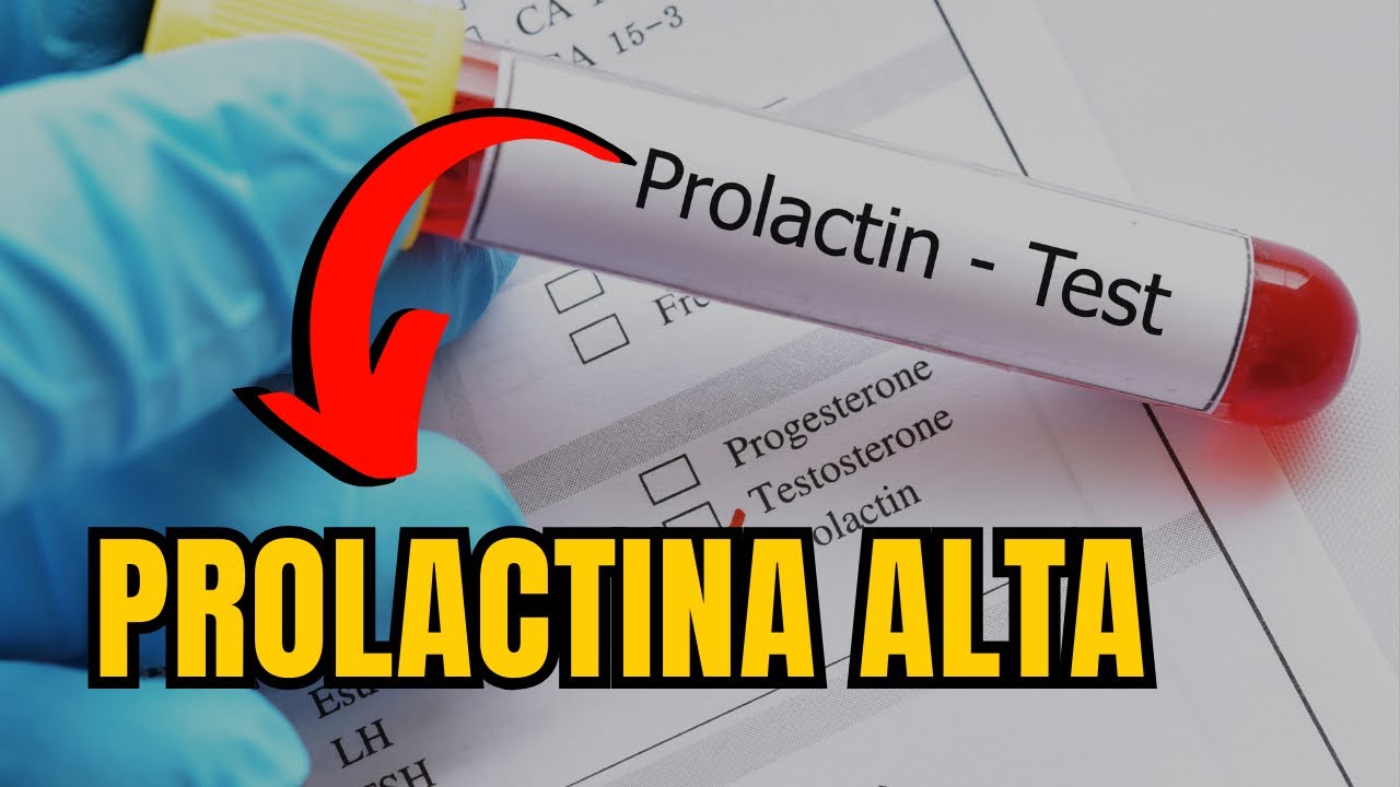 PROLACTINA ALTA: QUAIS OS SINTOMAS? QUAIS AS CAUSAS? COMO TRATAR?