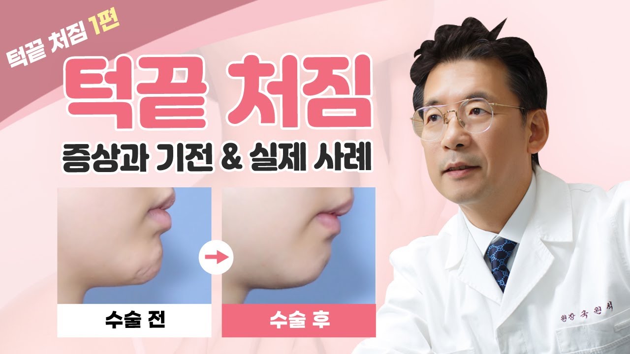 윤곽수술 부작용 발생 원인과  치료 사례 썸네일