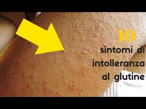 Da quali articolazioni dolenti e ossa è un segno Che curare hygroma congiunta