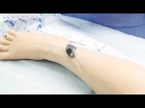 How to apply: 3M™ V.A.C.® Granufoam™ Bridge Dressing