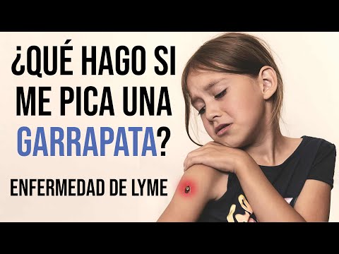 🩺 DIAGNÓSTICO y ABORDAJE INTEGRATIVO de la Enfermedad de Lyme (Borreliosis). Dra. Alejandra Menassa