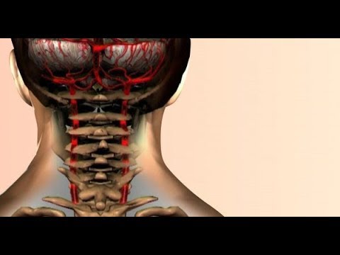 Dispositivo magia Corden per la guida il recupero della colonna vertebrale e delle articolazioni La mancanza di ossigeno al cervello con osteocondrosi cervicale