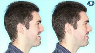 My Treatment Story | Mental Dental