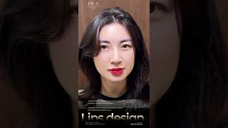 Lip Filler at DIVA Skin Clinic