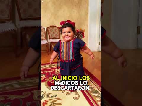 Bebé recién nacida sorprende al mundo al descubrirse que llevaba otro feto dentro.#Impactante #fyp