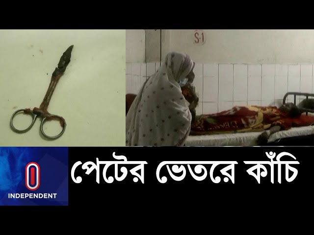 ২০ বছর ধরে বয়ে বেড়ানো কাঁচি অপসারণ ||Chuadanga Incident