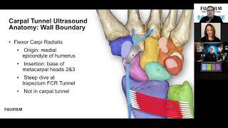 Carpal Tunnel Evaluation
