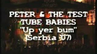 PETER AND THE TEST TUBE BABIES &quot;Up yer bum, Serbia&#39;07&quot;