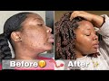 TruleyTalentedBeauty: " Mute (m)   0:09 / 12:24   WHEW Get Into THE SKIN | My Updated Skincare Routine | Fading Dark Marks, Smooth Skin & More"