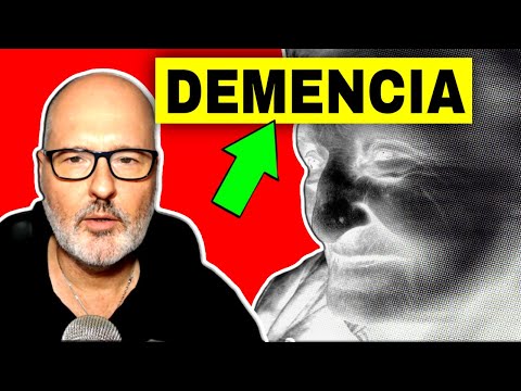 MY EXPERIENCE WITH DEMENTIA (ALZHEIMER) Symptoms, Causes, Treatment and Prevention
