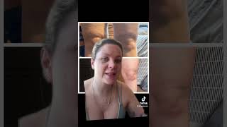 Lemon Bottle fat dissolving injections before and after ! #lemonbottle #lipoedema