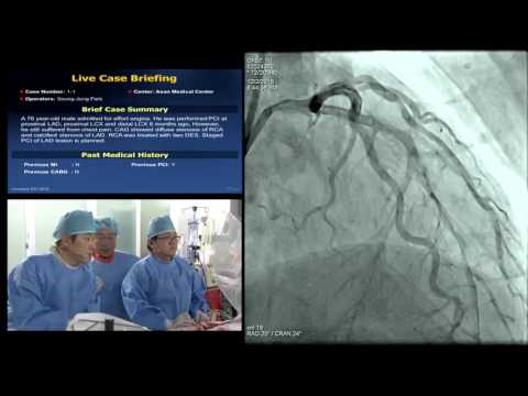 Complex PCI 2016_Live Case Demonstration (1/4)