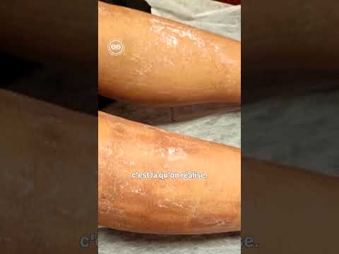 Elle ressort de son épilation brûlée au 2e degré... #M6 #Shorts