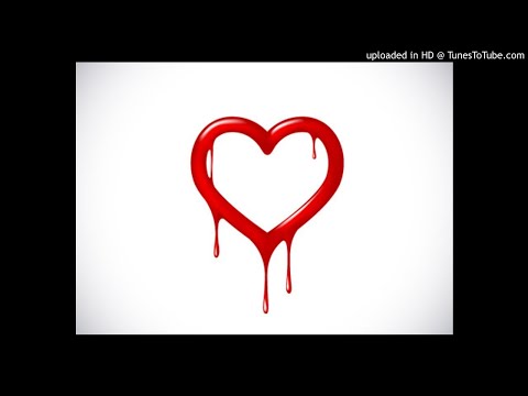 Zibba feat. Ideal - My Heart Bleeds *4x4 Bassline*