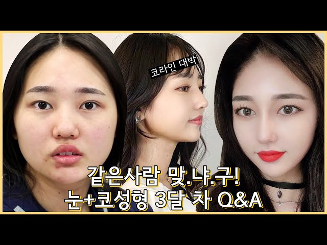 젊은감각! 프리미어성형외과 젊은감각! 프리미어성형외과