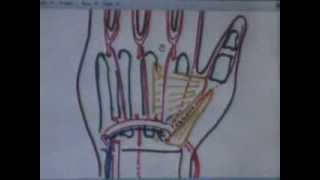 Dr.Medhat [Upper] 11/12/2013