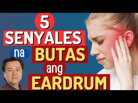 5 Senyales na Butas ang Eardrum. Paano Lunasan Ito. - By Doc Willie Ong.
