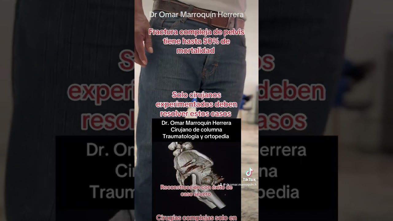 Omar Marroquín Herrera-116