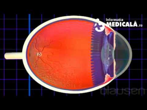 Îmbunătățirea vitaminelor acuității vizuale