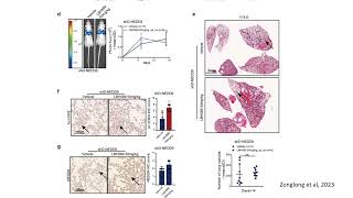 HDAC Inhibiors promote breast cancer metastasis