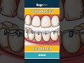 orthodontics - ortodoncia video thumbnail