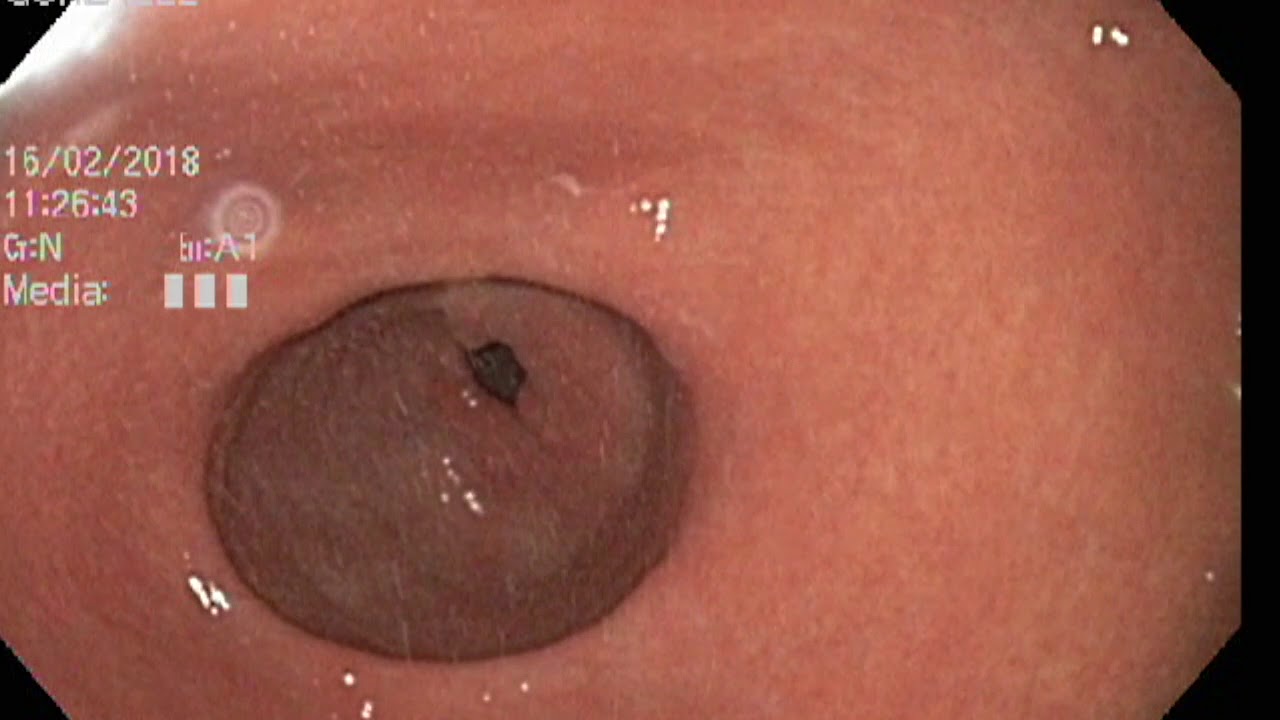 Adriana Fabiola Romano Munive-24