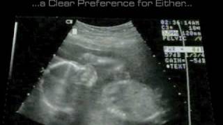 The Miracle of Life Hyper Pixel Media