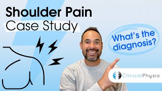 Shoulder Pain Case Study | Expert Physio Review guides you through Assessment and Diagnosis!
