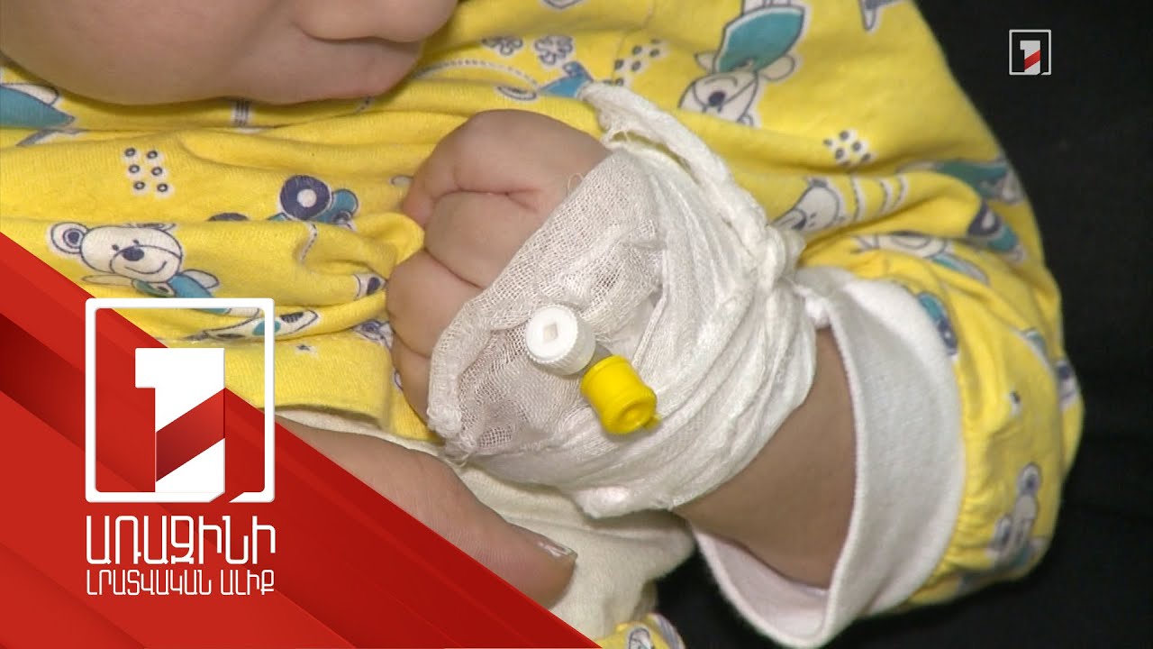 Հայաստանում սեզոնային շնչառական վարակները դեռ ակտիվ են. հոսպիտալացվածների թվում շատ են երեխաները