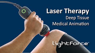 Deep Tissue Laser Therapy Medical Animation